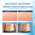 thumbnail image 2 of Crema de tratamiento de foliculitis Hermon Effective 100 g, 2 of 6