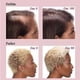 thumbnail image 2 of Hair Growth Supplements for Women, Thicker Fuller Hair Support for Thinning Hair and Hair Loss, 2 of 5