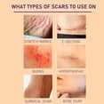 thumbnail image 3 of Silicone Scar Sheets,Silicone Scar Tape,Silicone Scar Removal Strips for Surgical,C-Section,Tummy Tuck,Keloid Scars Keloid Bump Removal, 3 of 7