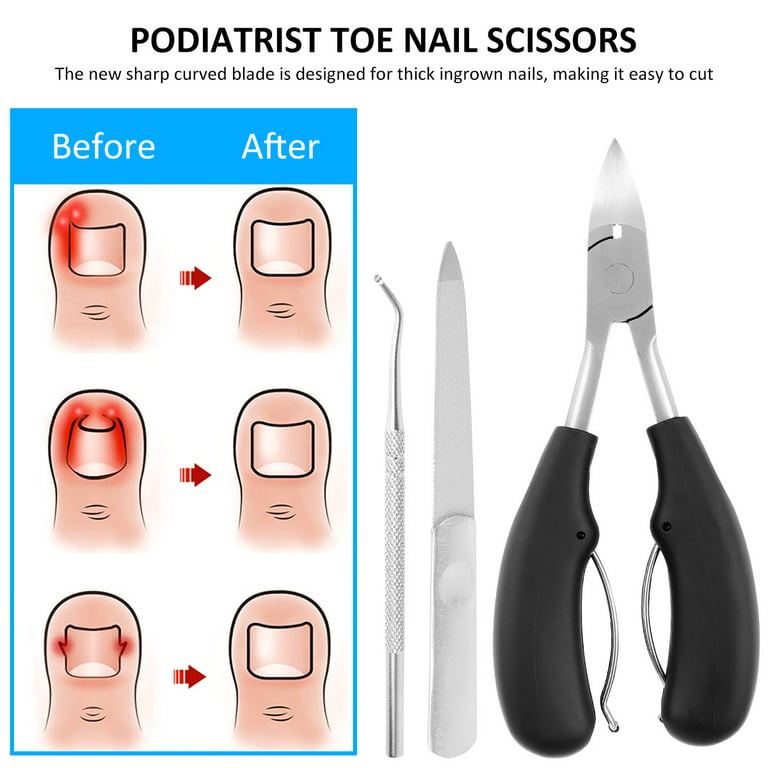 Nail Clippers, Long Handled Toenail Scissors Clippers for Seniors Thick  Toenails Ingrown Toenail Clippers,8 Inch Toe Nail Clippers Adult Thick  Nails