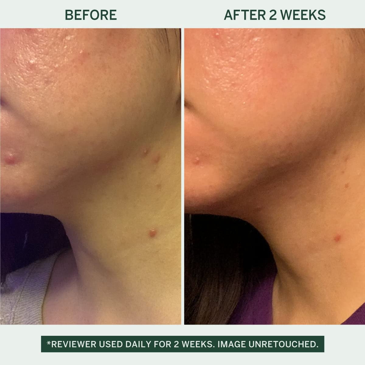 Urban Calm Barrier Cream Hydrating Face Moisturizer for Dry, Sensitive & Aging Skin with Hyaluronic Acid & Fermented Honeybush 1.69 Fl Oz