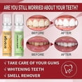 thumbnail image 4 of 5PC Fruit-Flavored Oral Spray Freshener Compact Portable Refreshing Cool Fresh Breath Oral Odor Care Breath Refresher Portable Mouthwash 22mlx5, 4 of 4