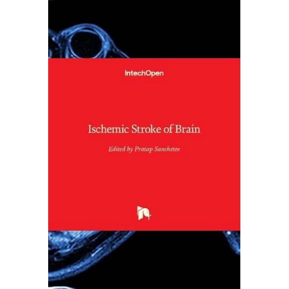 Ischemic Stroke of Brain (Hardcover)