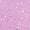 Pink Gem, variant on Toddler, Little, and Big Girls Jelly Clog