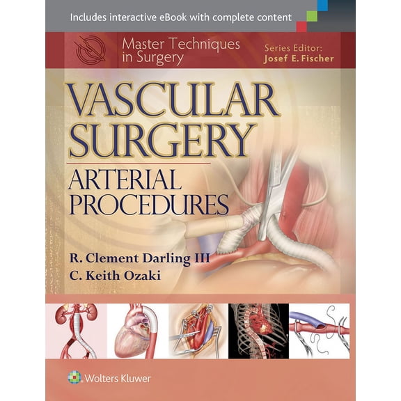 Master Techniques in Surgery Master Techniques in Surgery: Vascular Surgery: Arterial Procedures, (Hardcover)