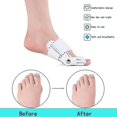 thumbnail image 4 of 2 Pcs Bunion Corrector For Women Hallux Valgus Brace Splint Pads, 4 of 4