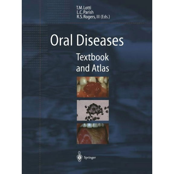 Oral Diseases: Textbook and Atlas, (Paperback)