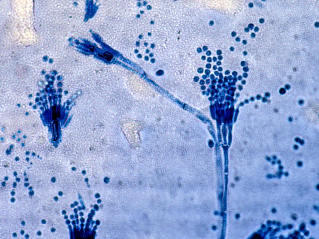 penecillium aspergillus spore microscope