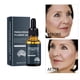 thumbnail image 4 of Suero facial con extracto hidratante, antiedad, reafirmante y suavizante, 30 ml, 4 of 4