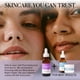 thumbnail image 2 of Suero de Niacinamida al 10% + Zinc Cosmedica Skincare Piel Sensible y Brillante, 2 of 8