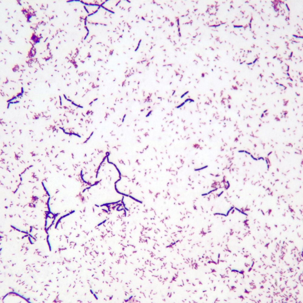 Mycobacterium Leprae Gram Stain