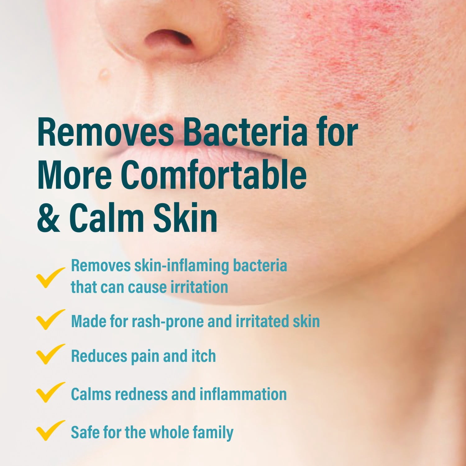 A+D Advanced Dermatitis Care Hydrogel Spray with Hypochlorous Acid 4 oz
