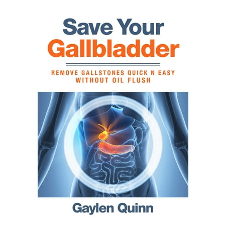 Save Your Gallbladder (Remove Gallstones Quick n Easy Without Oil Flush) - (Best Way To Remove Gallstones)