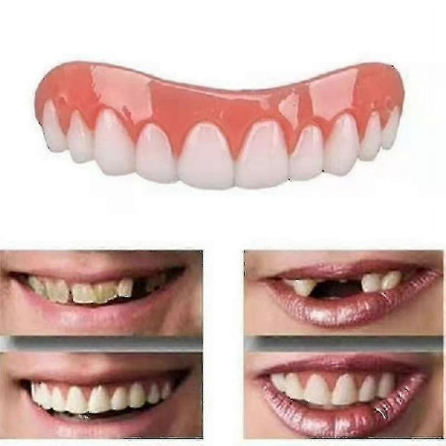 2 Sets Of Dentures, Upper And Lower Jaw Dentures, And Comfortable, Protect The Teeth, And Regain A Confident Smile