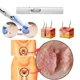 thumbnail image 4 of Lápiz láser para eliminar verrugas genitales Eliminación de verrugas en el ano Condilomas Herramientas de cuidado privado para hombres y mujeres, 4 of 6