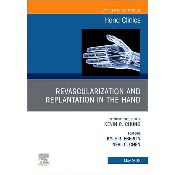 Revascularization and Replantation in the Hand, An Issue of Hand Clinics