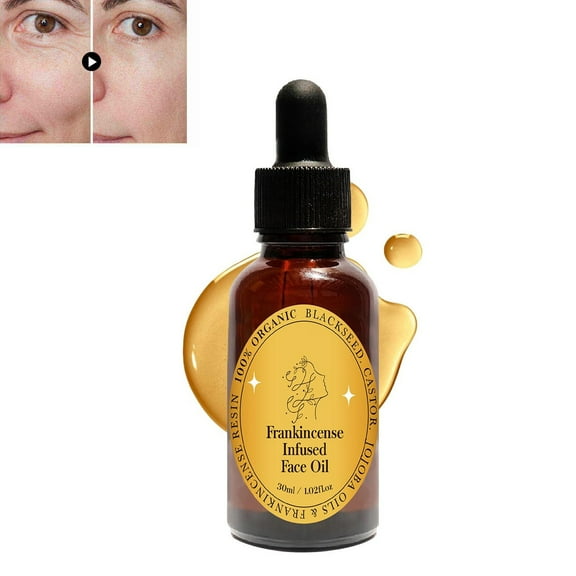 STARLAN Frankincense Resin Infused Oil for Face, Organic Frankincense Essential Oil, Natural Cold Pressed Frankincense Oil Nourishing for Dry Skin Care, 30ml