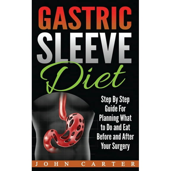 Gastric Sleeve Gastric Sleeve Diet: Step By Step Guide For Planning What to Do and Eat Before and After Your Surgery, Book 2, (Hardcover)