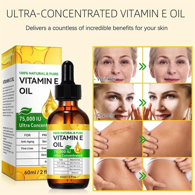 Aceite de vitamina E ultraconcentrado, 75.000 UI, 100 % orgánico, para tratar estrías, cicatrices, acné y arrugas - 60 ml/2 oz