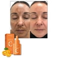thumbnail image 4 of Serum de Vitamina C BIOAQUA - Essence Antioxidante Blanqueador e Iluminador Facial 30ml, 4 of 6