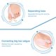 thumbnail image 3 of Corrector Hallux Valgus ZHAOCHENG 1 par de fundas protectoras para alisar El dedo gordo del pie, 3 of 5