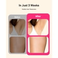 thumbnail image 4 of Jooyee-dispositivo IPL de depilación láser 22J, modo de doble ráfaga, eficaz y potente, depiladora de tratamiento para el hogar para mujeres y hombres, 4 of 5
