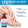 thumbnail image 3 of Eliminador de callos Aemerry con 17% de ácido salicílico, 30 ml, 3 of 8