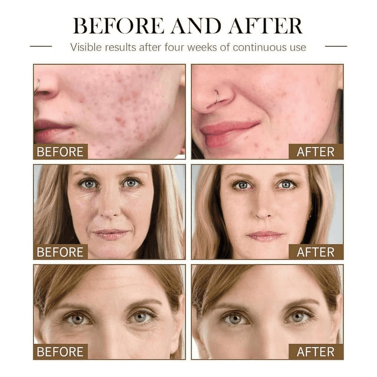 Castor oil on face deals