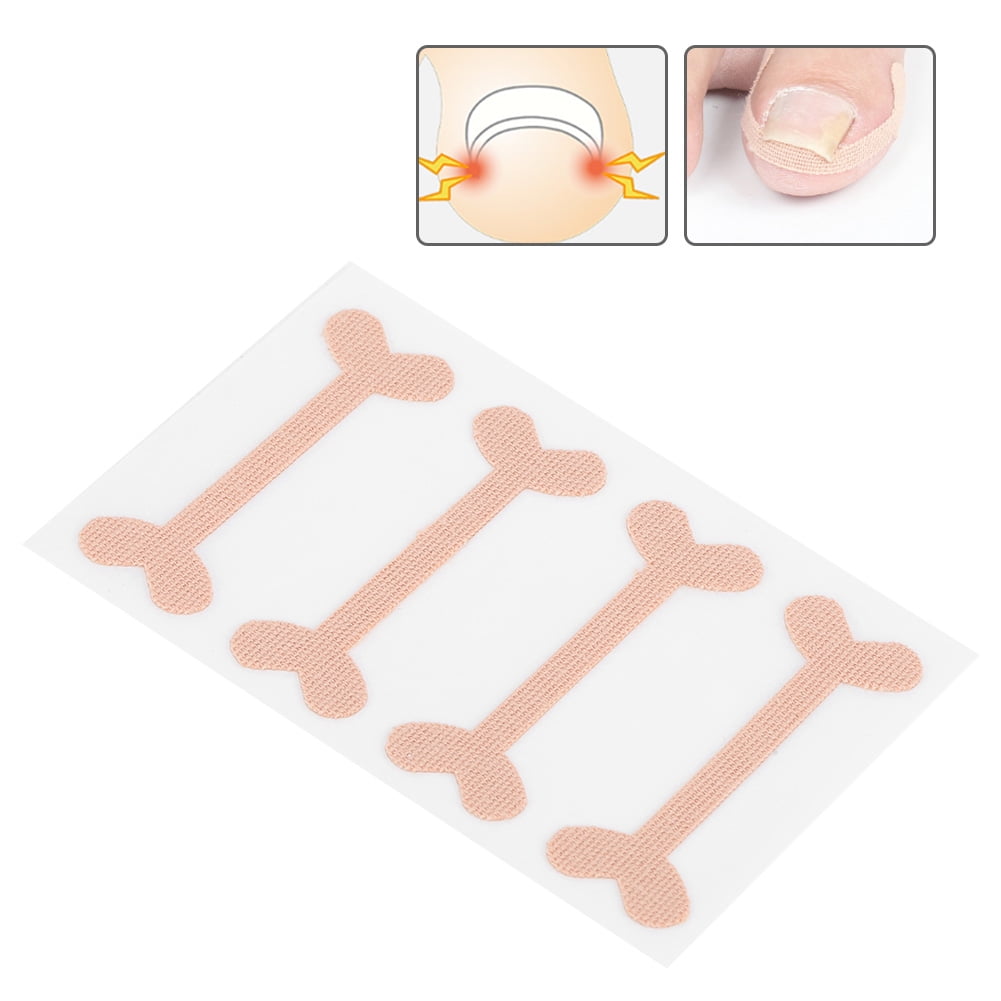 Brrnoo Nail Correction Bandage,Ingrown Nail Correction Bandage,24pcs ...
