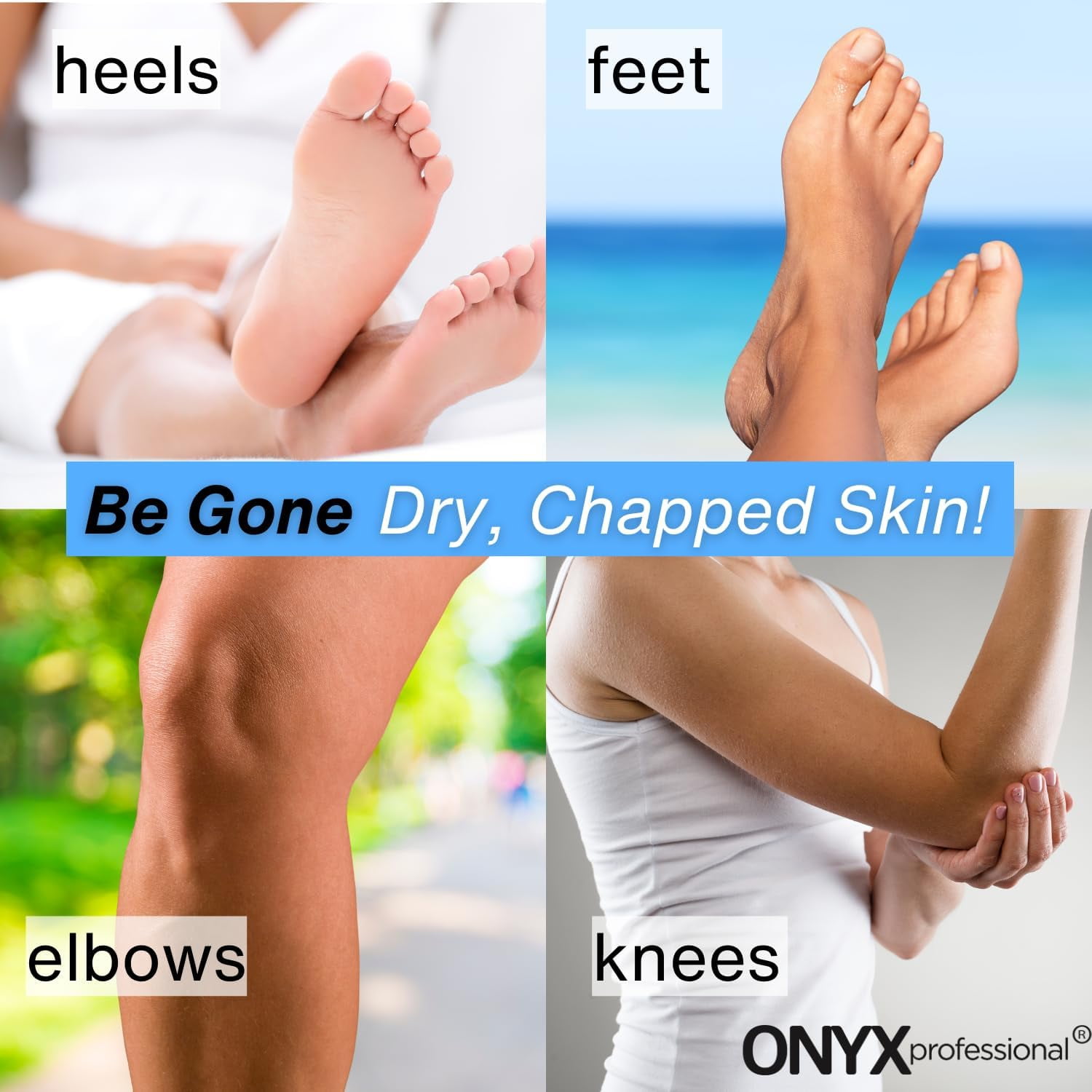 Foot Care Cream with Urea & Glycerin soften calluses and repairs dry skin & cracked  heels - Walmart.com