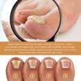 thumbnail image 4 of RAGUPEL Cuticle Remover,Instant Cuticle Remover Gel,Cuticle Softener with Instant 15-Second Removal for Hand,Foot And Nail Care,Eliminate Thick And Overgrown Cuticles(1Pc 30Ml/1Fl.Oz), 4 of 9