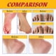 thumbnail image 5 of Xihbxyly Artículos en liquidación Crema reparadora de plátano para pies agritadoes, crema exfoliante, crema calmante natural para pies, hidratante, suaviza y tonifica los pies secos., 5 of 6