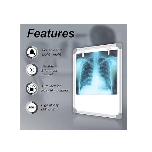 High-Brightness 14'' x 17'' LED X-Ray Viewer – Slim Design with Adjustable Illumination & Energy-Efficient Light Source"