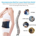 thumbnail image 2 of Cinturón de descompresión lumbar 6xigouma - Cinturón de soporte lumbar para hombres y mujeres, alivio del dolor lumbar, dispositivo de tracción lumbar, se adapta a cinturas de 74 a 125 cm (azul), 2 of 5