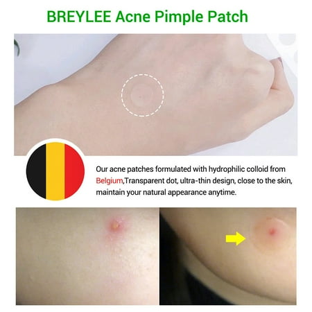 Tea Tree Pimple Patch Pimple Removal Sticker Skin Care Patch Walmart