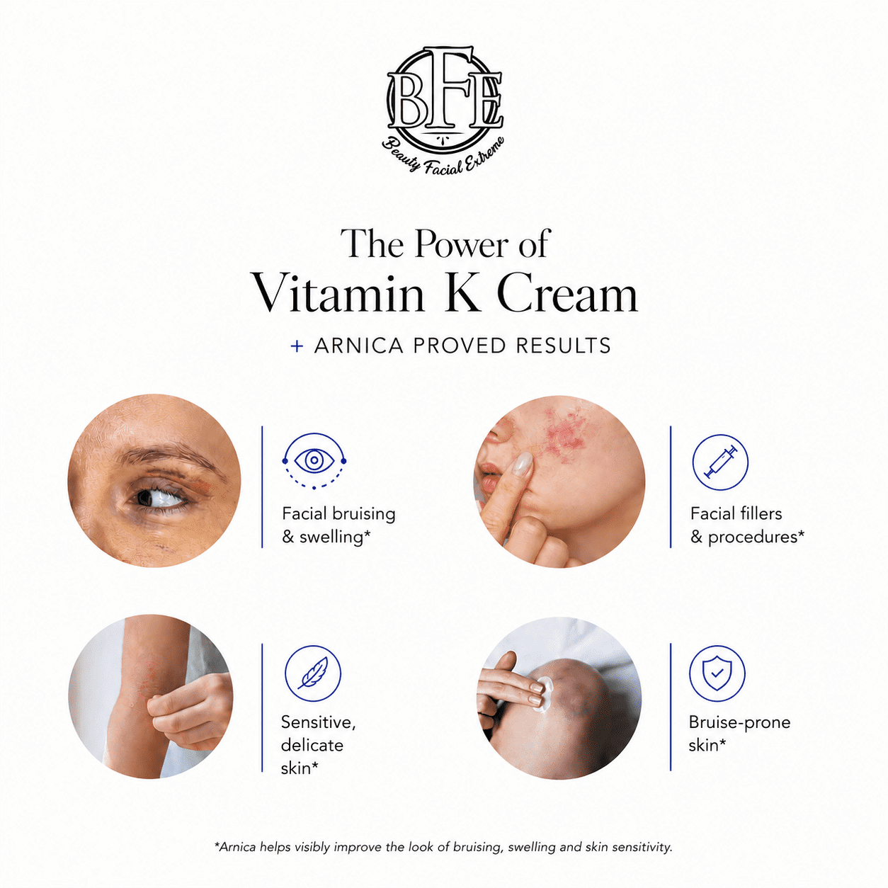 Beauty Facial Extreme Vitamin K Cream for Bruising, Spider Veins, Broken Capillaries, Under Eye Dark Circles, Fine Lines, Puffiness, and Wrinkles, 60 mL