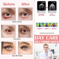thumbnail image 3 of 10 máscaras desechables de vapor para ojos para ojeras e hinchazón, calmante para el dolor de cabeza Jormftte CPB-US-WZY148-5, 3 of 5