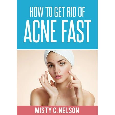 How to Get Rid of Acne Fast - eBook (Best Cream To Get Rid Of Acne Scars)