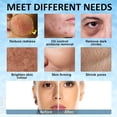 thumbnail image 4 of GFDYREE Rouleau de Glace en Silicone pour Visage et Yeux, Rouleau Facial de Glace Support de Glace pour Visage, Moule à Glace pour Visage Support de Glace pour Visage, Rouleau de Glace pour Visage Soin de la Peau, Glaçons pour Visage Rouleau de Glaçons Réutilisables, 4 of 7