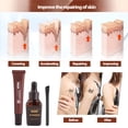 thumbnail image 2 of Corrector del tatuaje de la cicatrizsistema líquido profesional de la esencia del vitiligocrema correctiva del maquillaje del camuflajeconveniente para las marcas de nacimiento Khall JM06363, 2 of 6
