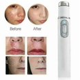 thumbnail image 4 of Spider Vein Eraser Blue Light Removal Eraser Treatment Wrinkles Acne Laser Pointer Scar, 4 of 5