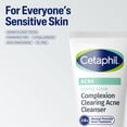 thumbnail image 4 of Cetaphil Gentle Clear Complexion-Clearing BPO Acne Cleanser with 2.6% Benzoyl Peroxide, Creamy and Soothing for Sensitive Skin, Suitable for All Skin Types, 4.2oz (Packaging May Vary), 4 of 10