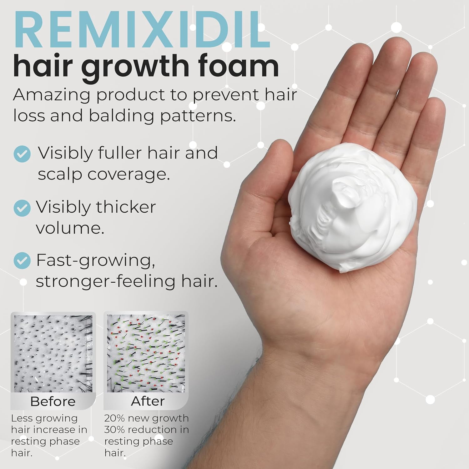 Men’s 5% Scalp Solution | Daily Leave-On Treatment for Thicker, Fuller-Looking Hair