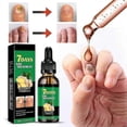 thumbnail image 3 of 7 Days Nail Fungus Treatment, Jaysuing 7 Days Nail Fungus Treatment, Ginger Nail Fungus Treatment_c*, 3 of 5