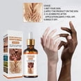 thumbnail image 4 of Esencia blanqueadora para nudillos, suero corporal para manchas oscuras, partes íntimas, elimina la melanina íntima, para el cuidado de la piel, 4 of 5