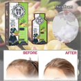 thumbnail image 2 of Ginger Plant Extract Anti-hair Loss Hair Shampoo, 2024 New Ginger Plant Extract Anti-hair Loss Hair Shampoo, Ginger Shampoo For Hair Growth_c*, 2 of 5