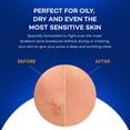 thumbnail image 4 of Toallitas faciales Zocular ZocuZap Acne con complejo de okra, 30 unidades, 4 of 7