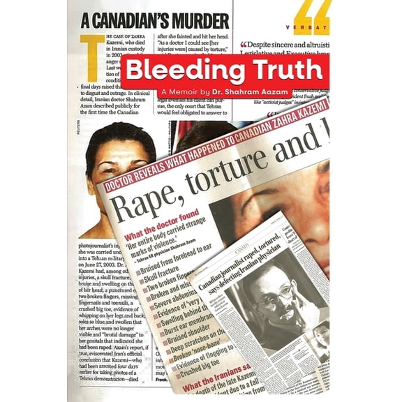 Bleeding Truth, (Paperback)