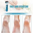 thumbnail image 3 of rpe Pieds Electrique Anti-callosit, Lime Pour Pieds Professionnelle De Pdicure Pour Eliminer Les Peaux Mortes Et Craqueles, 2 Ttes De Rouleaux In, 3 of 5