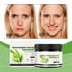 thumbnail image 4 of Fiudx Crema Salicílica, Hidrate Minimizadora de Poros, Crema Facial de Hidratación Profunda, Alivio para Piel Seca, Solución Antiedad, Rutina Diaria de Cuidado de La Piel, Apta para Todo Tipo de Piel, 4 of 7